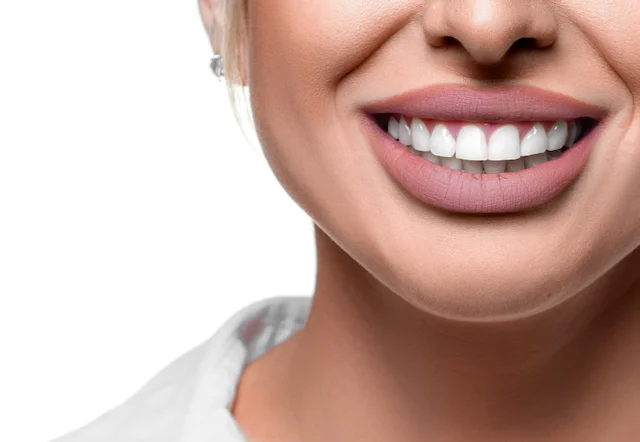 dentalni viniri indikacije